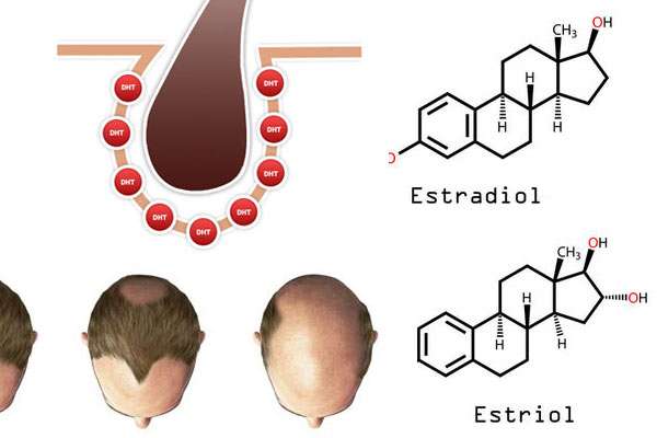 Estrogen hair loss